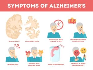 symptoms of alzheimer